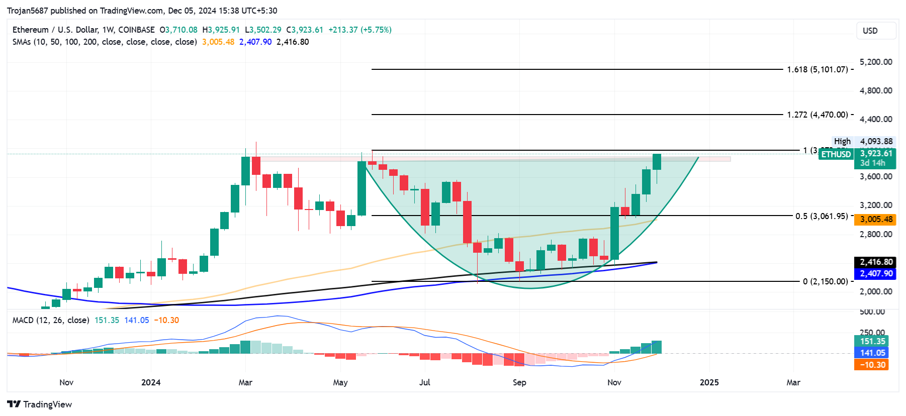 COINBASE:ETHUSD Chart Image by Trojan5687