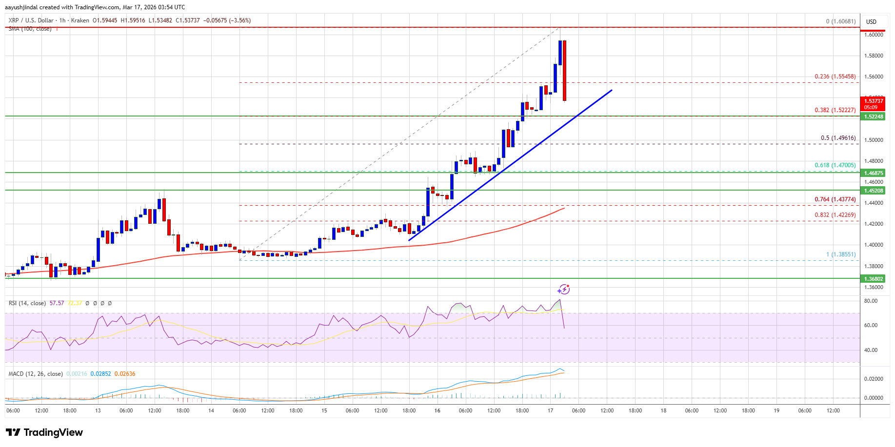 XRP price chart above $1.50 with $1.58–$1.60 resistance